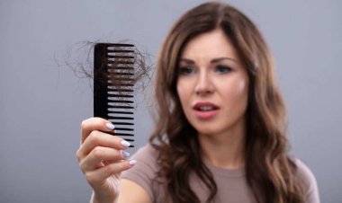 How to Control Hair Loss